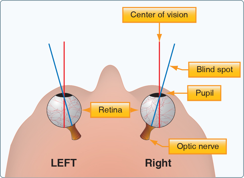 What is the blind spot in eye?